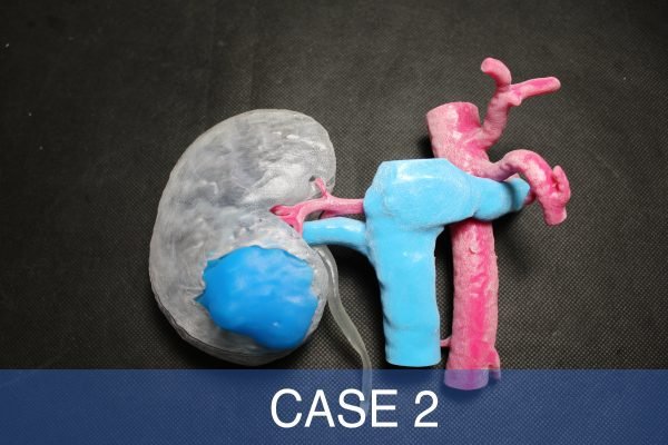case21-min